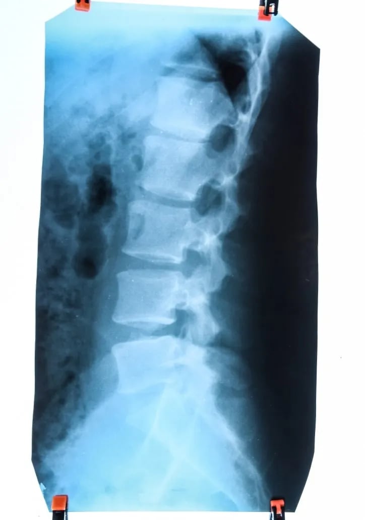 The back is literally the body’s support column. Made up of 33 bones called the vertebrae, it is a channel that makes all body movements possible by enabling nerve signal transfer from the brain to all body parts. 